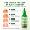Nail Fungomer Showing Results Nail Lab Premium Nail Care Serum for Fingers & Toes