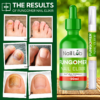 Nail Fungomer Visible Results Nail Lab Premium Nail Care Serum for Fingers & Toes
