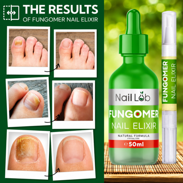 Nail Fungomer Visible Results Nail Lab Premium Nail Care Serum for Fingers & Toes